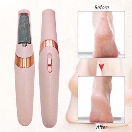 Foot Callus Remover
